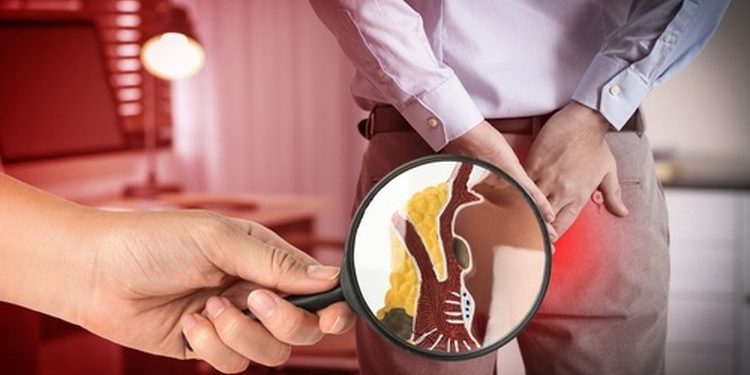 Cara Alami Untuk Mengatasi Ambien